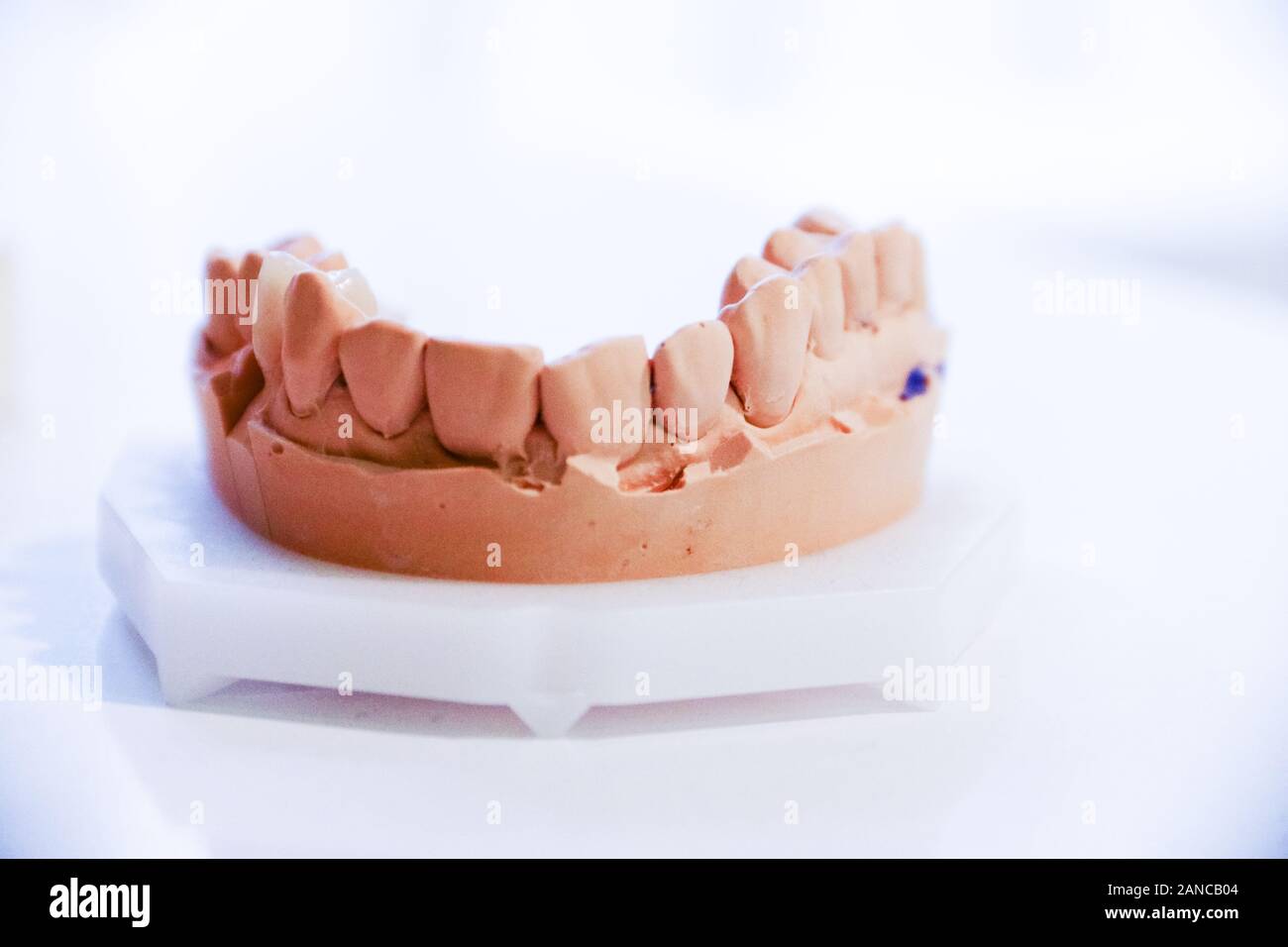 Getta della ganascia. Formazione presso il dentista. Denti anatomici stampe. Istruzione per l'ortodontista. Foto Stock