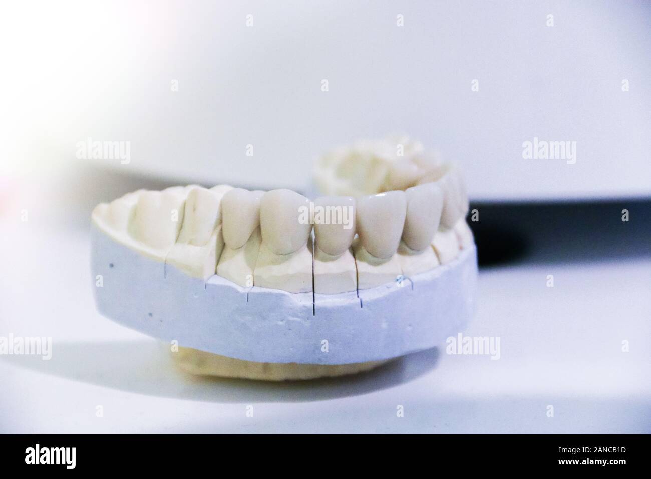 Getta della ganascia. Formazione presso il dentista. Denti anatomici stampe. Istruzione per l'ortodontista. Foto Stock