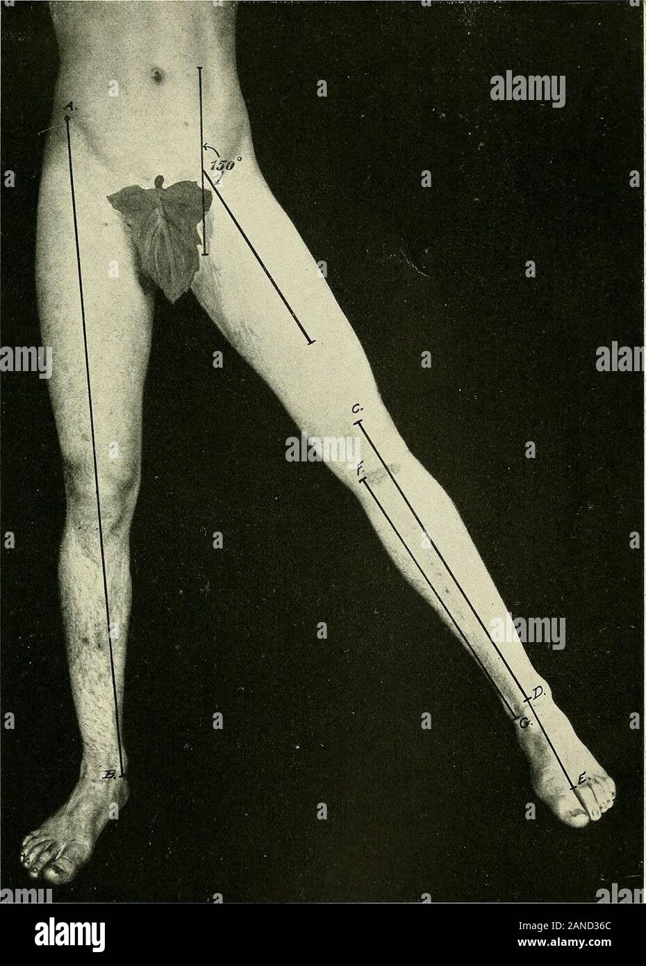 Un libro di testo di anatomia clinica : per studenti e professionisti del settore . 23. Sul piede palpare il tubercolo di scafoide appena al di sotto di ein anteriore del malleolo interno. 24. Palpare la tuberosità del calcagno in cui il tendoAchilis è inserito. Palpare anche il giunto tra i cunei interni-forma e il primo metatarso ossa sul lato interno del piede e la jointbetween il cuboide e il metatarso del mignolo. Nota Il actionat il metatarso-falangea, che consiste nella flessione, estensione,alcune abduzione ed adduzione-che è, da e per il centro lineof s Foto Stock