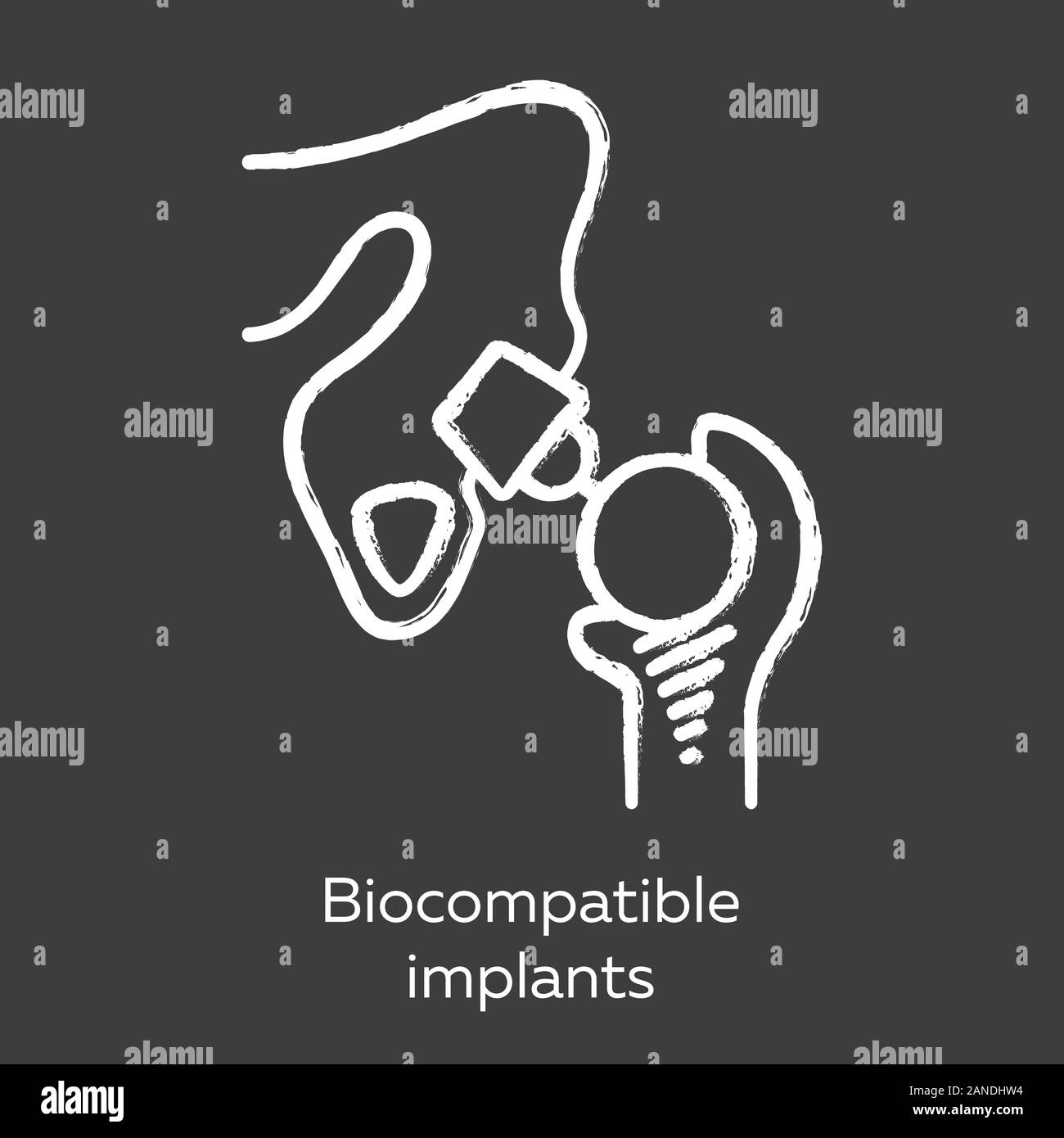 Impianti biocompatibili chalk icona. Compatibile con il tessuto vivente materiale. Articolazione artificiale. Dispositivo protesico. La struttura biologica sostituire. Bioengin Illustrazione Vettoriale