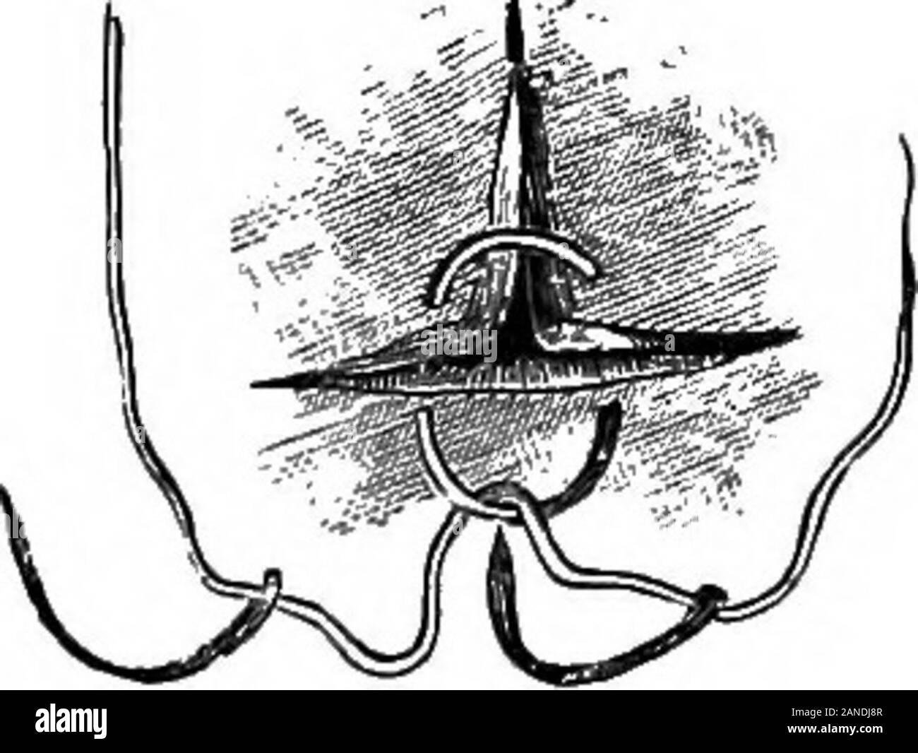 Un illustrato enciclopedico dictionaryBeing medico un dizionario dei termini tecnici utilizzati da scrittori sulla medicina e la garanzia delle scienze, in latino, inglese, francese e tedesco . // - V CROSS sutura.. Fare doppio NEEDLEn sutura. mascella. [C. 3.]-fronto-nasale s. Ger., Stirnnasennaht. La s.tra il frontale e ossa nasali. fC, 3.]-fronto-parietal s.Vedere coronali s.-fronto-sphenoidal s. Lat., sutura spheno-frontalis. Ger., Keilnaht. Il s. tra l'osso frontale eil alee di sfenoide. [L, 332.] anteriore-o-temperatura orale s.s. tra il frontale e temporale delle ossa. [L.]-Fu Foto Stock