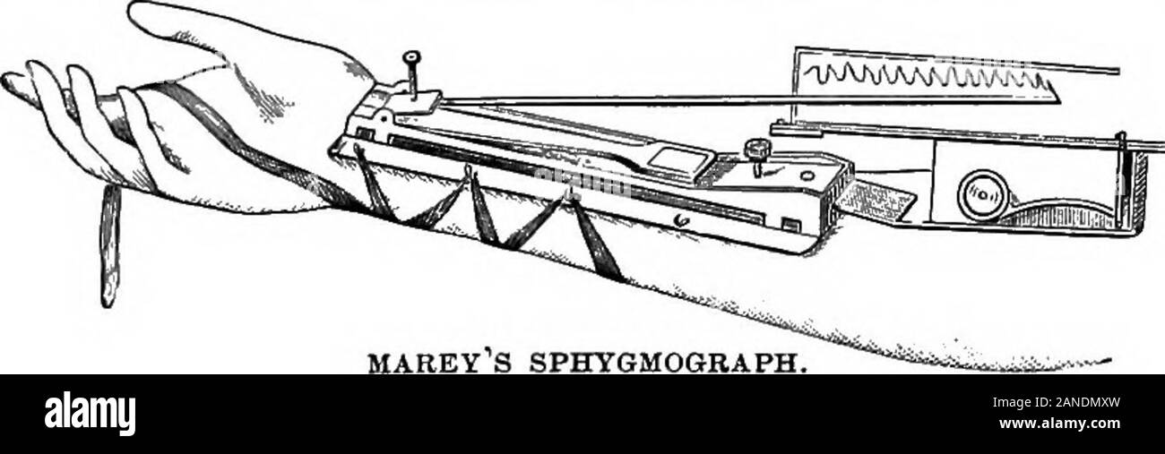Un illustrato enciclopedico dictionaryBeing medico un dizionario dei termini tecnici utilizzati da scrittori sulla medicina e la garanzia delle scienze, in latino, inglese, francese e tedesco . ve. Essa consiste essentiallyof un pulsante che è collocato sopra l'arteria, qualsiasi movimento com-municated a cui è registrato da un indice su di un foglietto di paperwhich è mosso da un orologio. [K] SPHYGMODIC, adj. Sfl^g-moMik. Gr., 0-(J.u7^Ico"iis (fromo-c^vyMo?, il polso e elSos, somiglianza). Lat., sphygmodes, Fr.,sphygmodique. Ger., pulsdhnlich. Impulso-simili, pulsazioni lilte thepulse. [K.j. SPHYGMOGRAM, Foto Stock