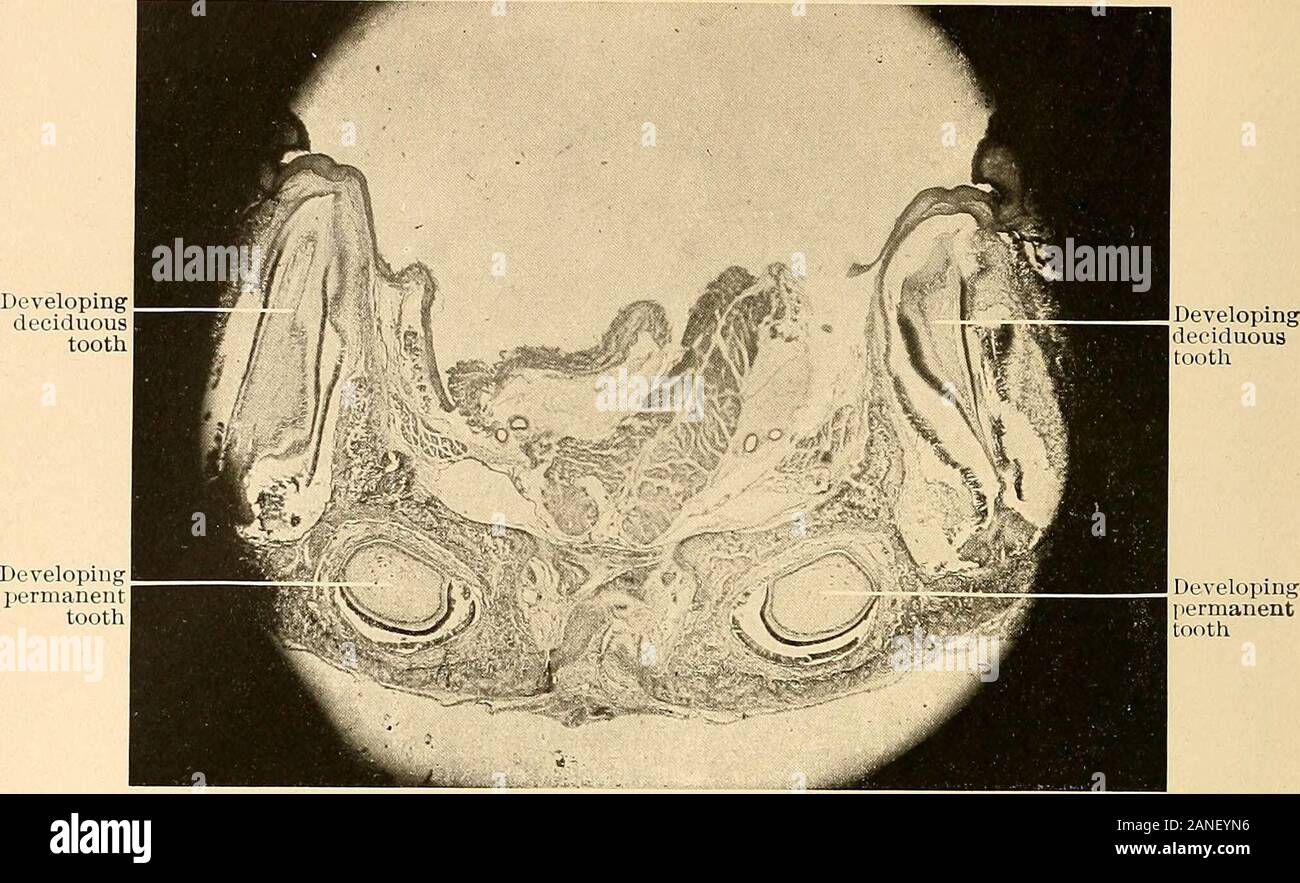 Principi e Pratica di odontoiatria operativa . dente follicolo -Fig. 206.-Sezione di ganascia di coniglio, mostrando i denti decidui e follicoli di denti permanenti in situ a periodo dell'eruzione dei denti primari. X 22.. Sviluppo di Fig. 207.-la ganascia inferiore del campo fcetal-mouse. X 80. Foto Stock