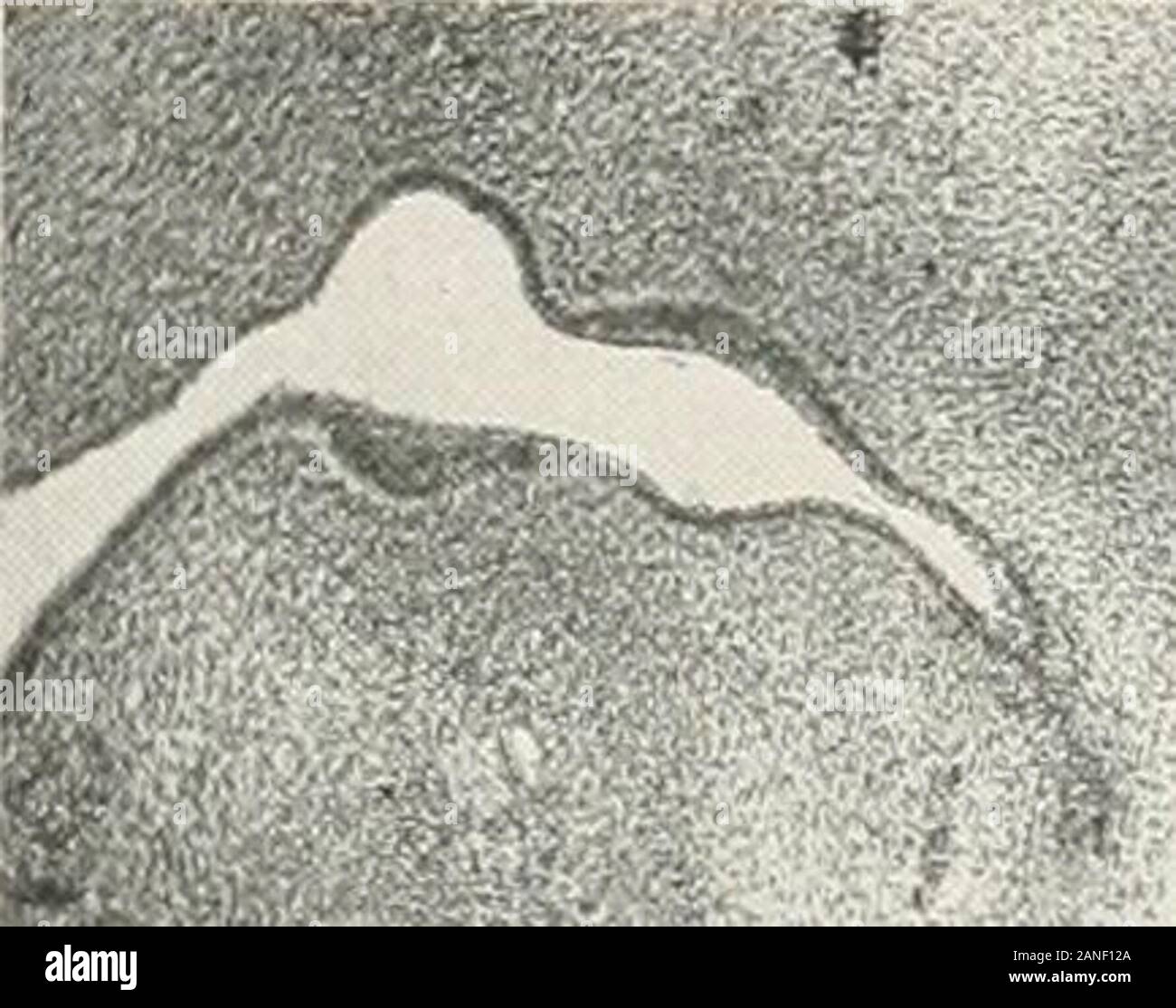 Contributi alla anatomia e sviluppo delle ghiandole salivari nel mammalia . La FIG.71.. La FIG.72. Foto Stock