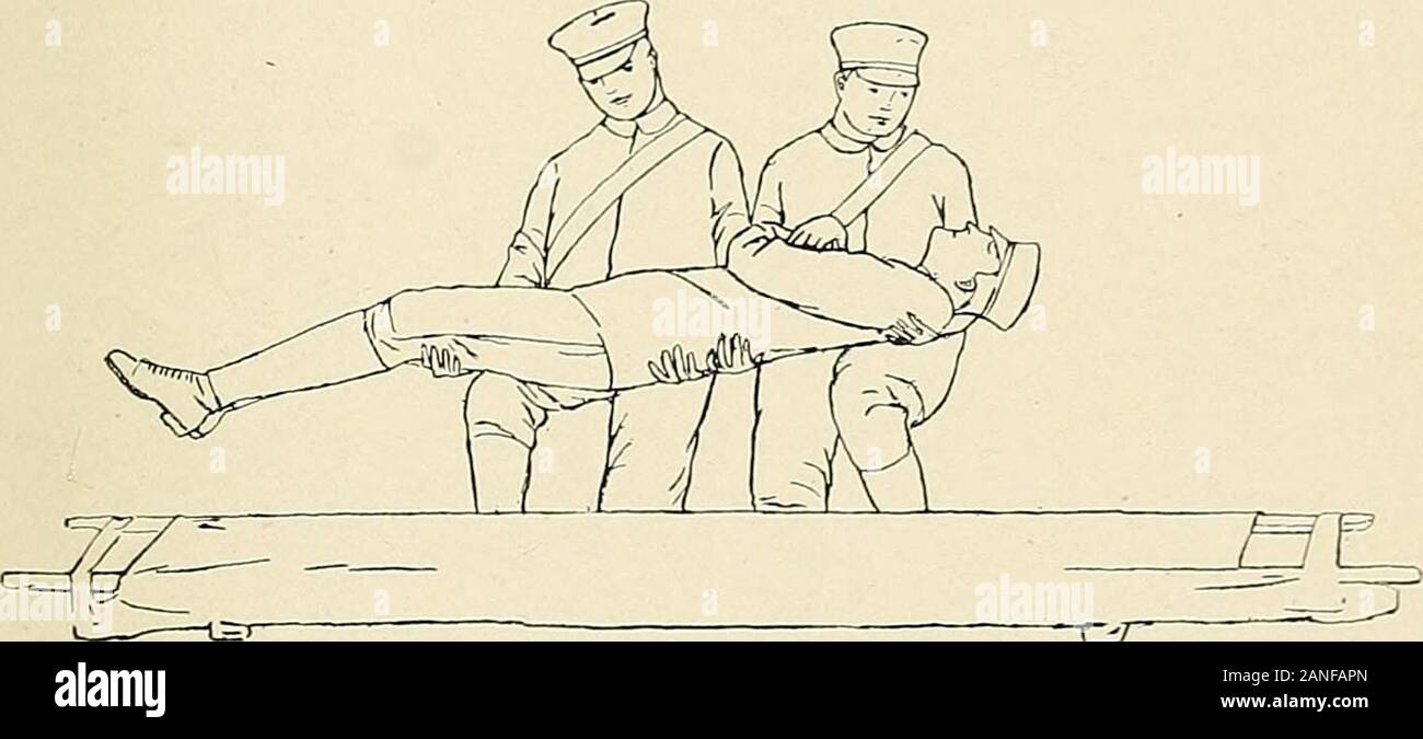 Un libro di testo di primo soccorso e di un trattamento di emergenza . om le spalle e mette il loopon l'anello maniglia, l'ansa abbracciando la maniglia opposta. Essendo in corrispondenza del sollevamento: in avanti. Marzo. Il bearer fase off, Xo. 1 con la sinistra e n. 2 conil piede rigido, tenendo brevi fasi di scorrimento di circa 20 pollici, trasporto di lettiera 201 per evitare contraccolpi e per assicurare un movimento uniforme per la lettiera.La cadenza è a circa 100 passi al miiuite. La marching movimenti con il htter sono molto similarto quelli della squadra nell'esercito Manuul tranne che com-me lettiera sostituisce quella di fours e ordinaril Foto Stock
