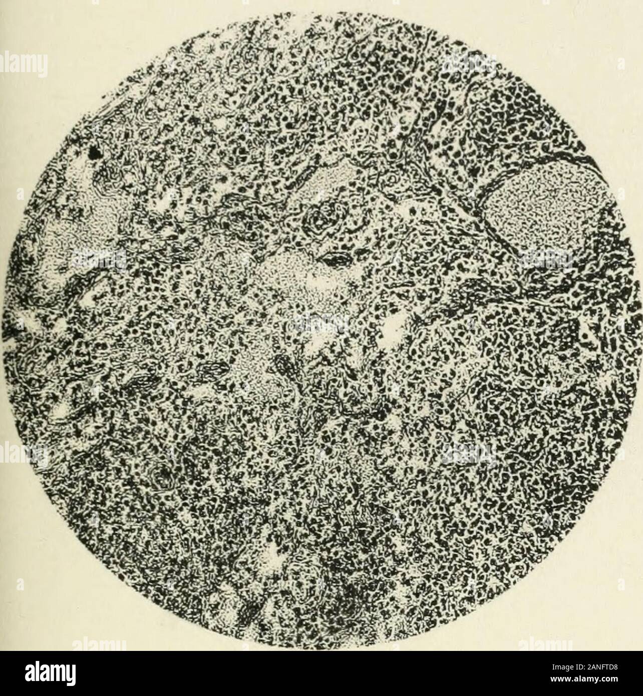 Annali di medicina tropicale e parassitologia . Annali trappola. Med. & Parasitol., Vol. VII PIASTRA XXXIII. Foto Stock