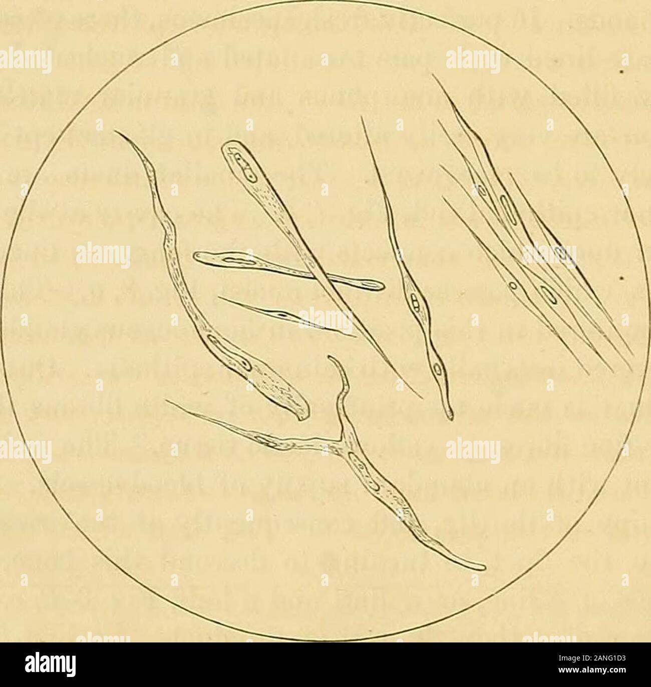 Ricerche su il veleno del rattlesnake : con un'inchiesta dell'anatomia e fisiologia degli organi interessati . Un, cellule epiteliali del condotto principale e della presa alla base del premistoppa; 6, pigmento-cellule di condotto. Fig. 9.. NON STKIATED MdSCULAB FiBEE-cellule dello sfintere OP il condotto. Su caieful esame della natura di questo tessuto, ho trovato formedby un aumento nella quantità di tessuto fibroso e mediante aggiunta di uno strato di OP il veleno del RATTLESNAKE. 15 allungato cellule fusiforme, Fig. 9, aventi ciascuna un singolo nucleo, e talvolta una lunga,dark nucl Foto Stock