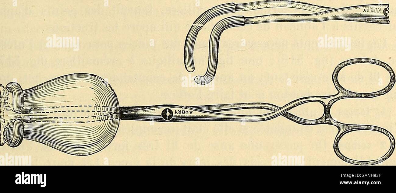 Traité de gynécologie clinique et opératoire . au fer rouge consécutive. Une des osservazioni, qui estpersonnelle à Rosset, data de 1555. Les deux femmes guérirent. Jai rapporté grandnombre onu de faits de ce genre dans une thèse, Sur la valeur de Vhystérotomie, 1875, p. 149. - Voir aussi Dexucé, Traité de linversion utérine. Parigi, 1885. 2 Aran, cit., p. 914, - Mac Clintock, cit., p. 85. - Suis, cit., p. 155. -V- Faucon (sur une forme particulière dinversion polypeuse de lutérus, inversionsupero-laléraie, amputée par lécraseur linéaire avec la sutura. Bull, de lAcad roy. deBelgique Foto Stock
