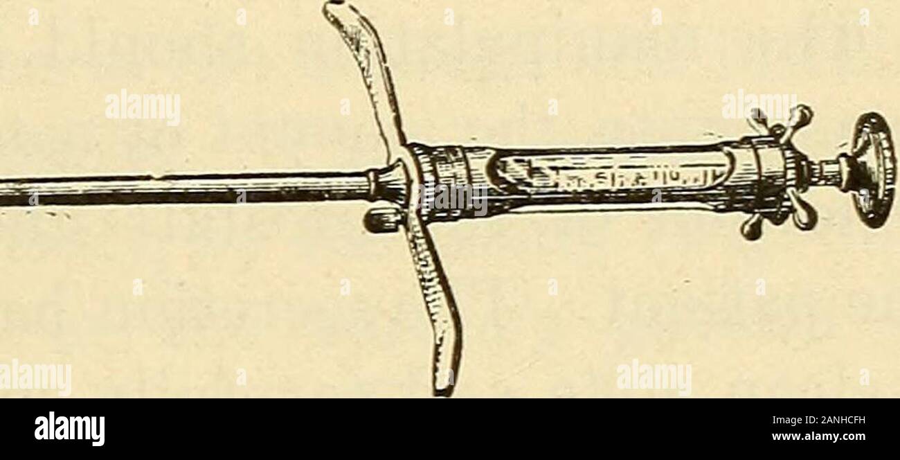 La gonorrea nel maschio : una guida pratica per il suo trattamento . Fig. 32, Keyes profonda siringa uretrale. inserita delicatamente nel retto, abbiamo prima mappa svitarela prostata e vescicole, e poi lentamente e a cura di applicare completamente la pressione prima di prostata e laterto vescicole. L'avambraccio del massaginghand dovrebbe essere in linea con l'asse dell'patientsbody, e il chirurgo deve gettare il peso ofhis corpo contro il suo gomito (Fig. 24). Lo scopo della procedura dovrebbe essere a emptythe ghiandole e follicoli di loro patologica di detriti,e stimolando la circolazione nell'organo,ripristinare ad esso Foto Stock