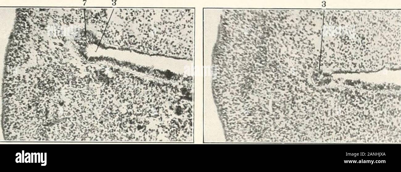 Contributi alla anatomia e sviluppo delle ghiandole salivari nel mammalia . j7. Ipofisi (levetta). j5. Orbitoparotid. jp. Circonflessa solco. 40. Ispessimento epiteliali tra il tamburo intermedio e sulci linguale. 41. Mesenchimale sottomascellari condensazione. XI la piastra di Fig. 2. Trasversale di sezione frontale del solco buccale in un 7.5 millimetro embrione umano vicino al angulus oris. Raccolta di Columbia, n. 22g, diapositiva 4, riga 4, sezione 8, X 187, ridotto 5.Fig. 3. Stesso embrione, diapositiva 4, riga 4, sezione 2. Più sezione caudale del solco buccale.Fig. 4. La ricostruzione di epitelio orale di 20 m Foto Stock