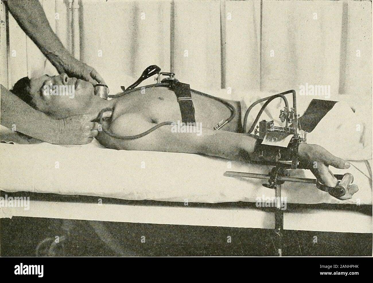 Malattie del torace e i principi di fisica diagnosi . ^difficili da stimare a causa delle ridotte dimensioni e relativamente profondo situa-zione dell'arteria. Come età aumenta gradualmente la pressione tende a salire, generalmente a theratio di circa 1 mm. Hg. per ogni due anni di vita, assumendo che ayouth di venti anni ha una pressione di 120 mm. Hg. Pressione readingsabove 160 mm. {Sistolica) o 100 mm. (Diastolica) se costantemente presente deveessere considerato patologico a qualsiasi età. Il significato del sangue anomalie di pressione maggiore della pressione del sangue è clinicamente più comune e più diagnosticallyfar Foto Stock