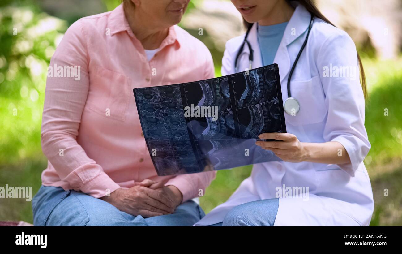 Terapista del sesso femminile per spiegare la diagnosi paziente mostra immagine a raggi x, medicina Foto Stock