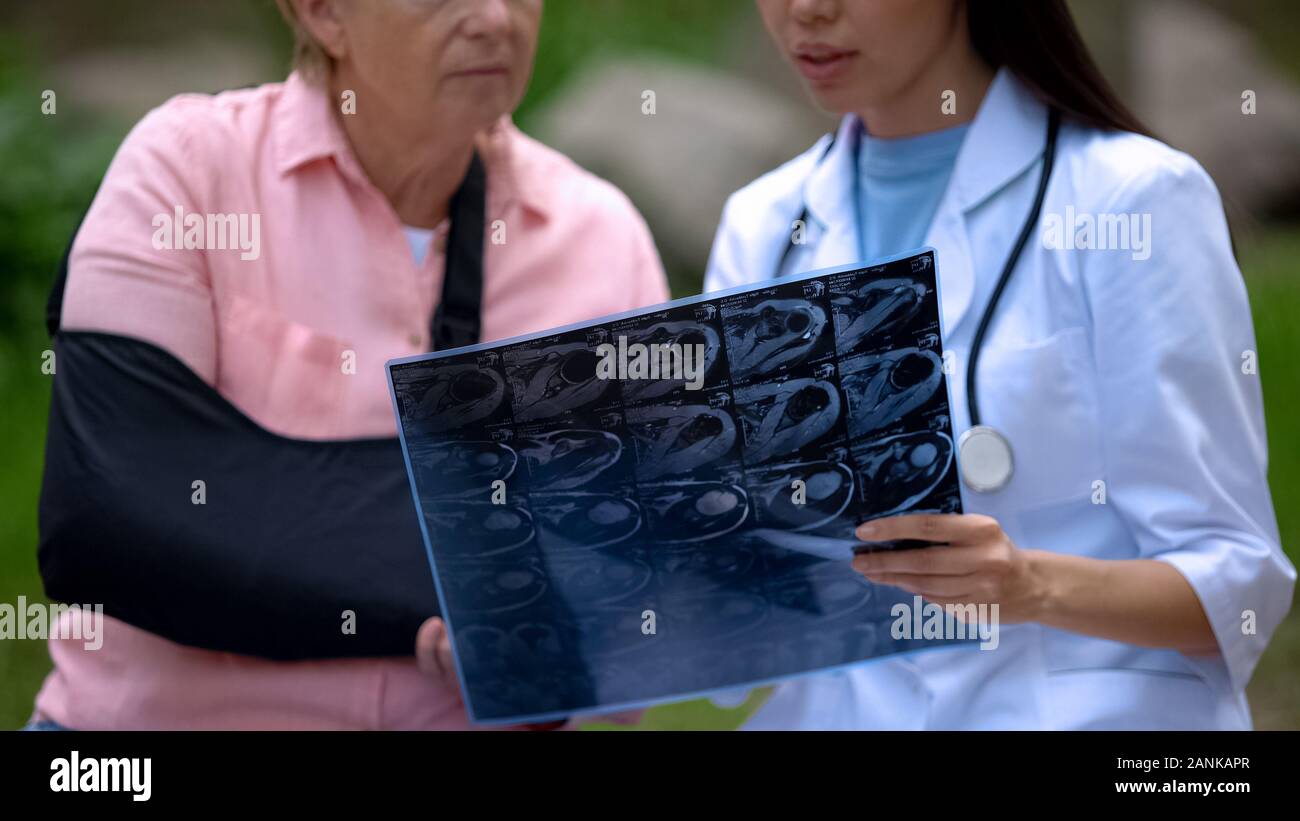 Medico femmina mostra immagine a raggi x per maturare la paziente di sesso femminile di indossare l'imbracatura del braccio Foto Stock