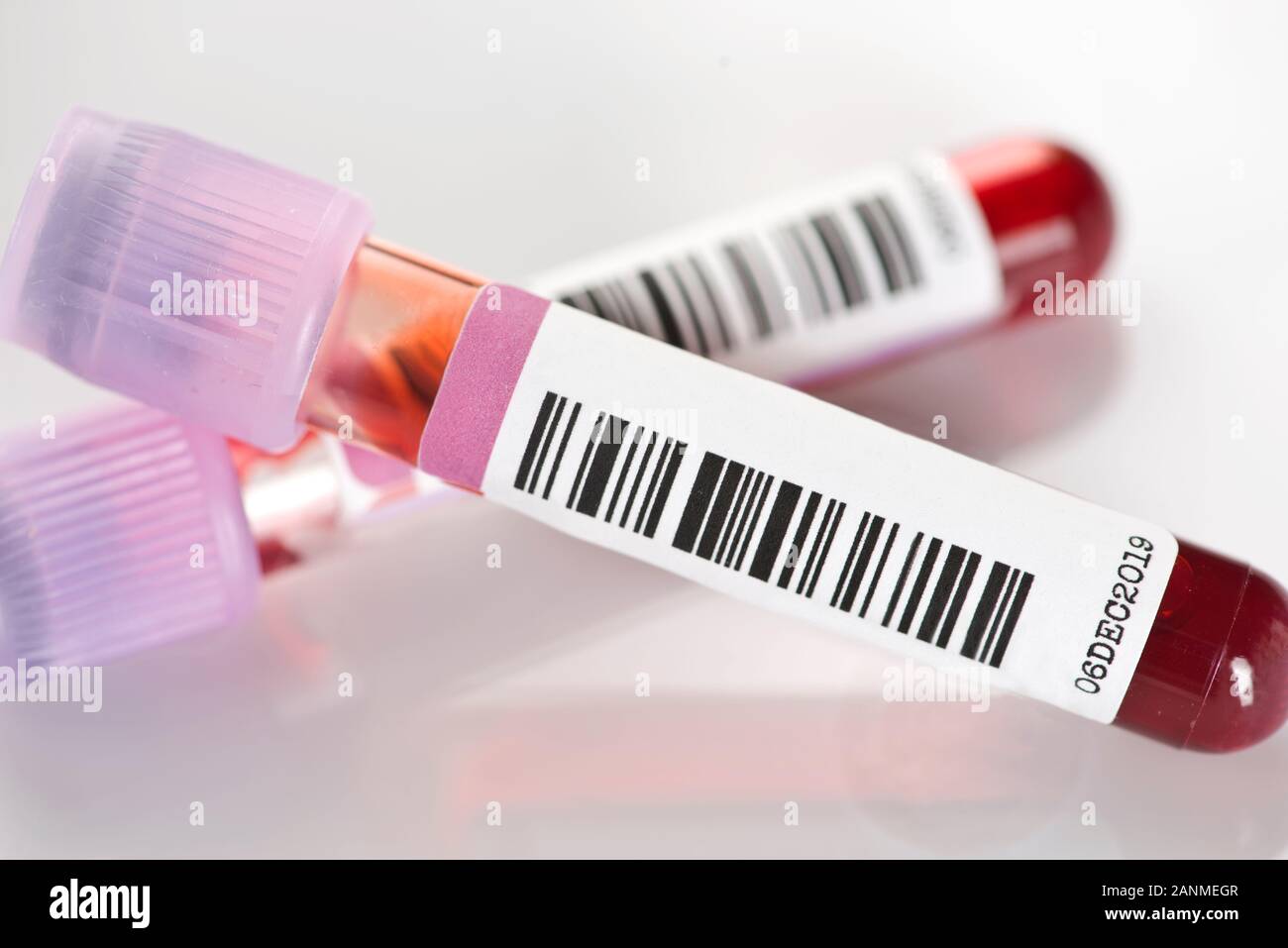 Il sangue provette con la lavanda o viola tops. Usato per esami del sangue come completare nel conteggio delle cellule ematiche, HbA1c, e anemia. Foto Stock