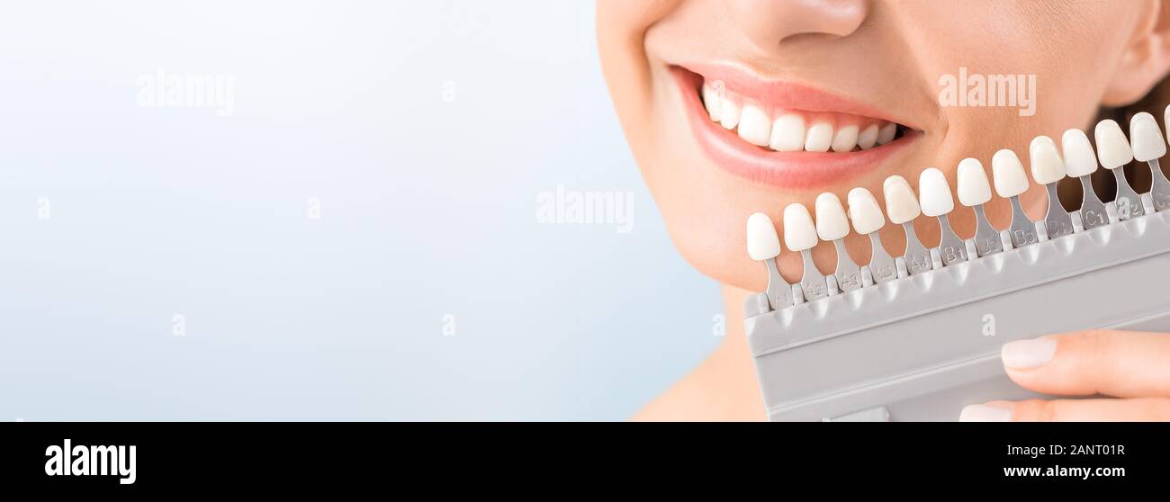 Bel sorriso e denti bianchi di una giovane donna. Matching le sfumature delle protesi mammarie o il processo di sbiancamento dei denti. Foto Stock