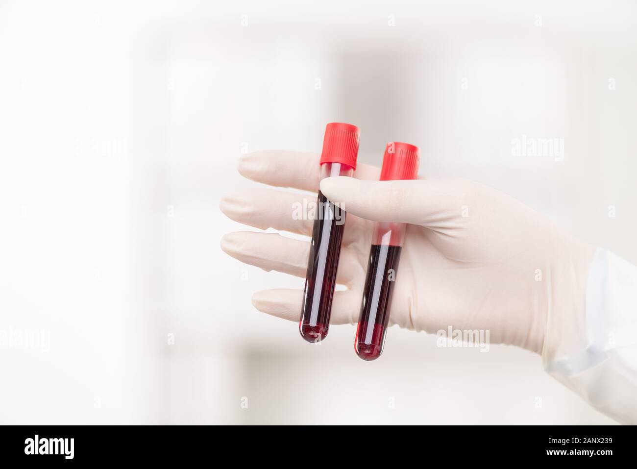 La mano guantata della femmina contemporanea medico tenendo due beute Foto Stock