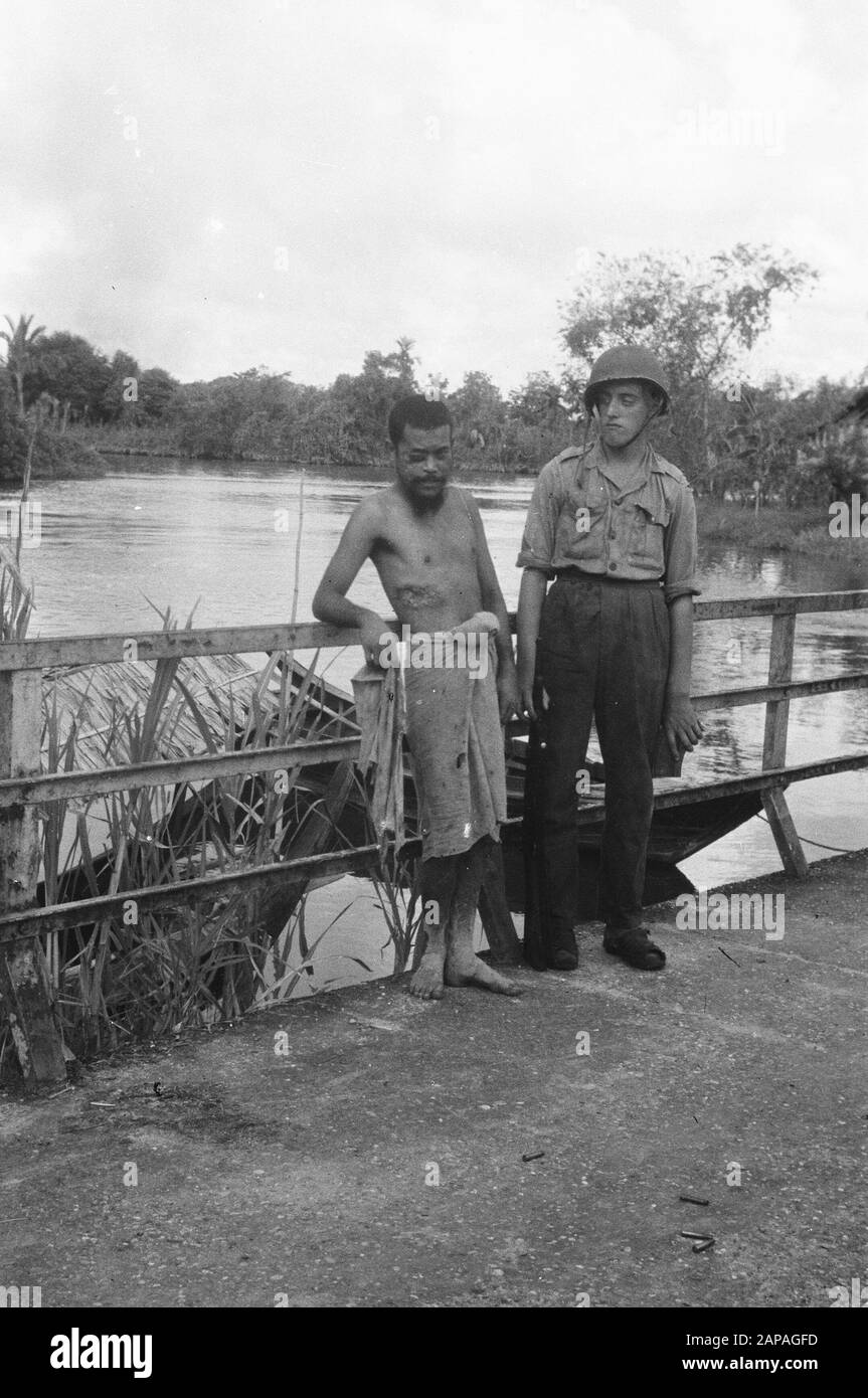 Foto Liberation North Sumatra Descrizione: L'esercito olandese Jan Snijders ut Hantem in Friesland si è incontrato durante l'operazione Sea Snake in South Asahan questo sofferente di lamboesia, un esempio della condizione medica trascurata della popolazione. Annotazione: L'uomo è ferito al suo occhio destro e ha anche una grande ferita in basso a destra Data: 19 dicembre 1948 luogo: Indonesia, Indie orientali olandesi, Sumatra Foto Stock