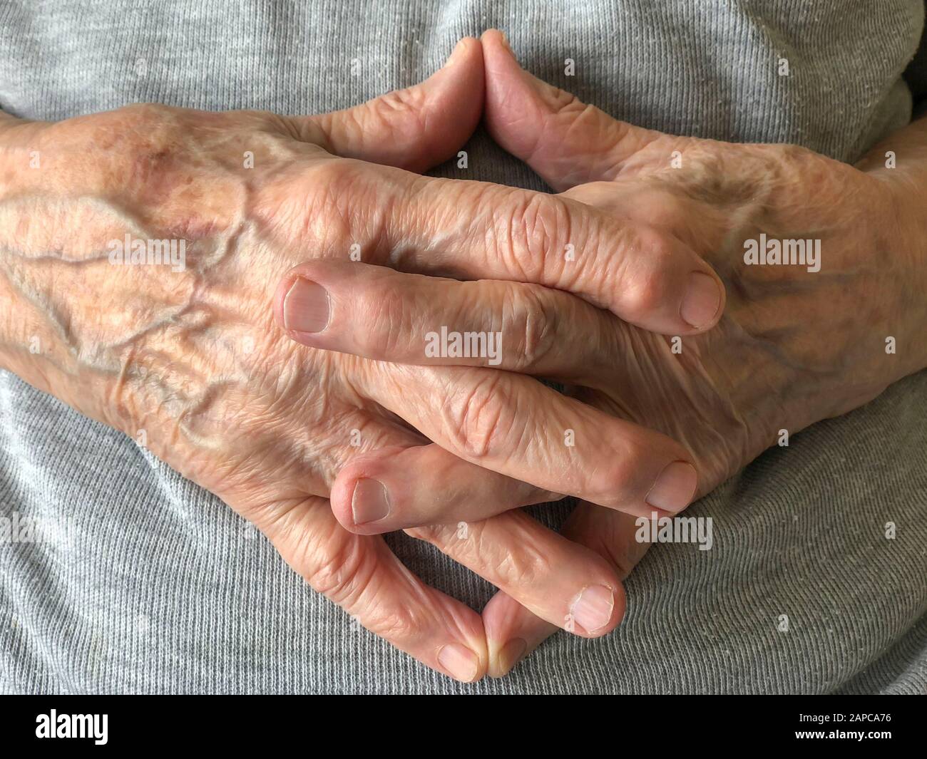closeup rugose mani di una persona anziana Foto Stock