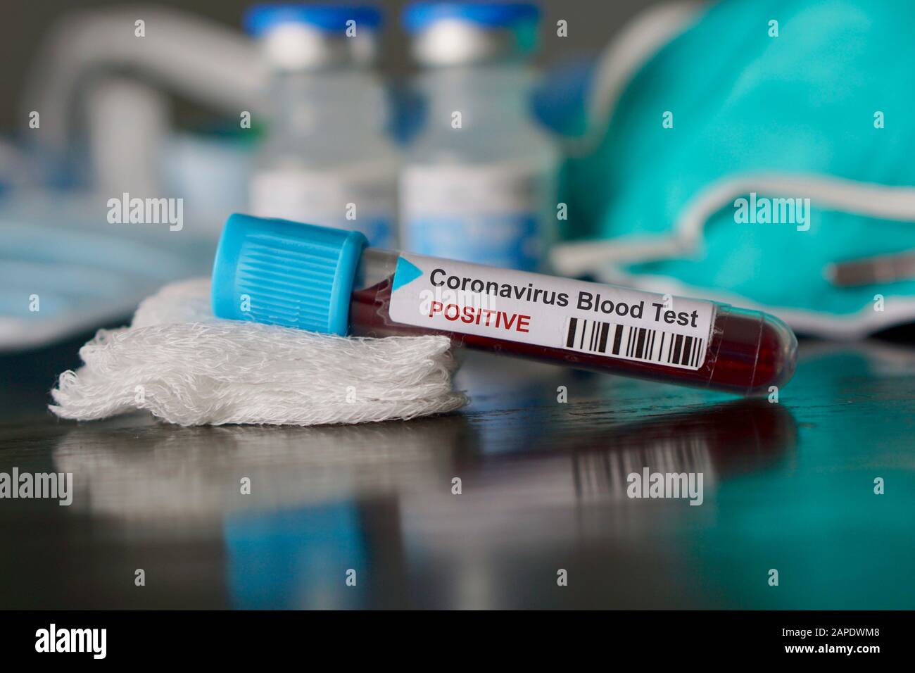 Risultato positivo del test del sangue per il nuovo Coronavirus, che si sta diffondendo rapidamente, originario di Wuhan, Cina Foto Stock