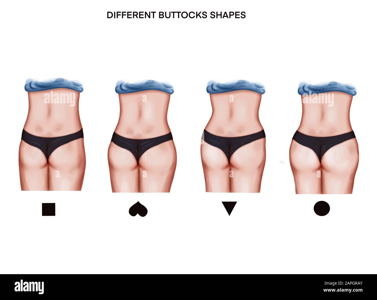 Illustrazione delle diverse forme dei buttots Foto Stock