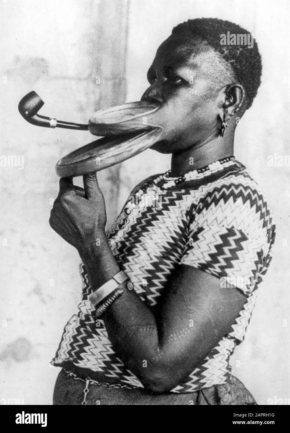 La donna con le labbra più grandi del mondo, Gustika della tribù Negro  [Duckbil], che aveva un tubo fatto con un boccaglio extra lungo, si  esibisce a New York con un circo,