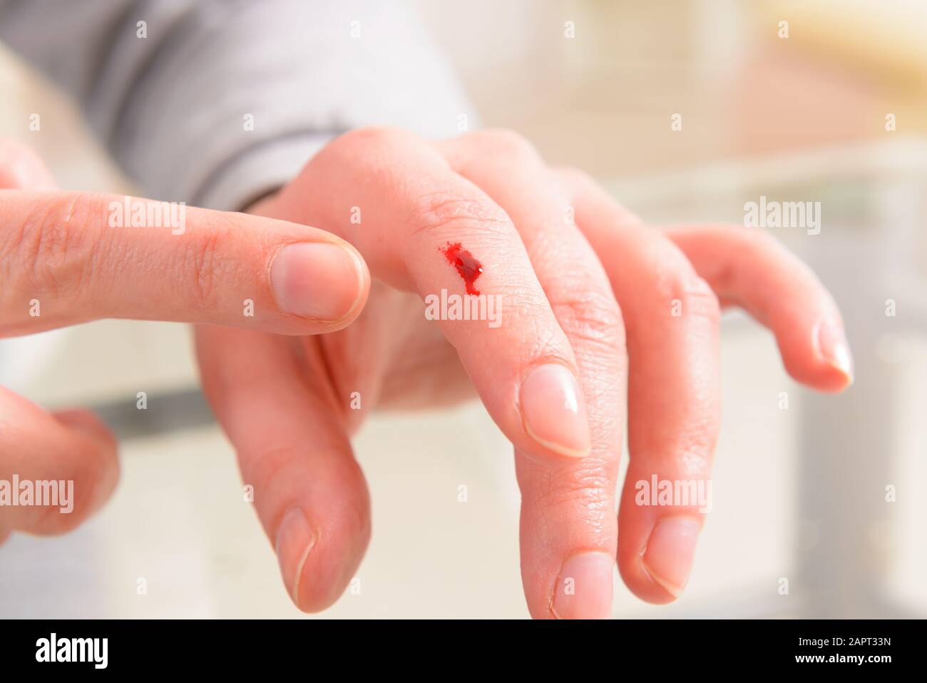 Dito sanguinante, mano con una ferita con sangue visibile Foto Stock