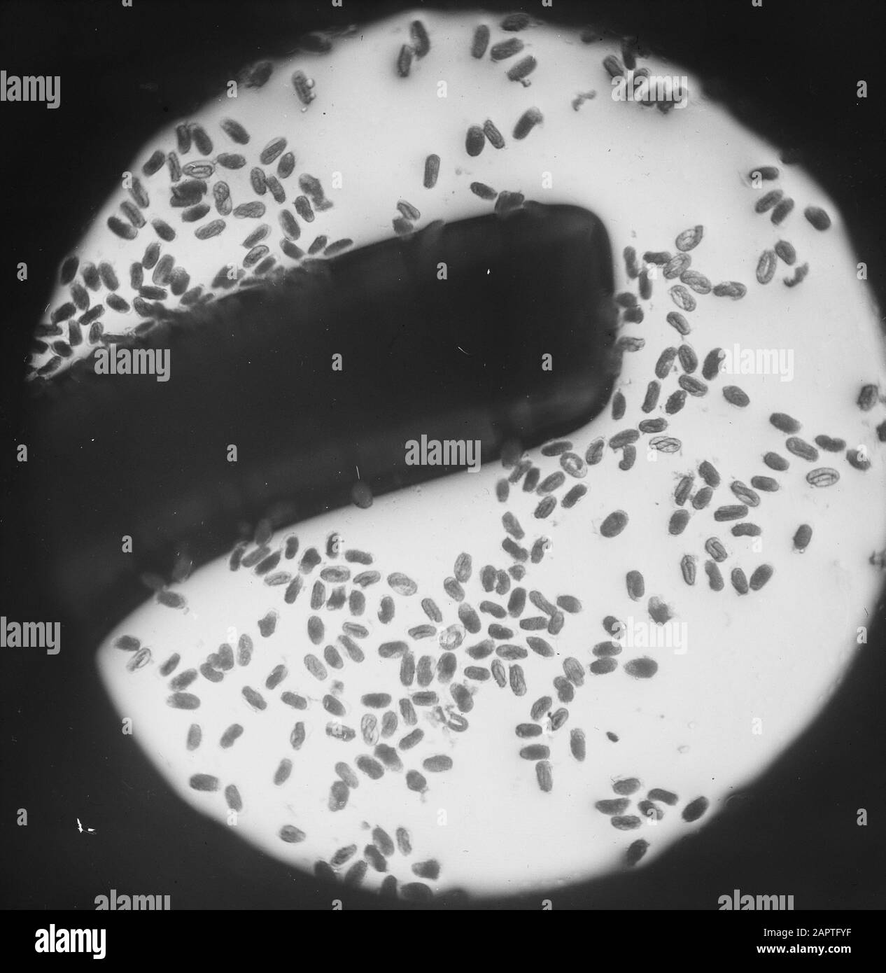 Microlphoto di femmine e maschi ed embrion del worm polmonare Data: Parole Chiave dense: Cervi, malattie, mammiferi Foto Stock