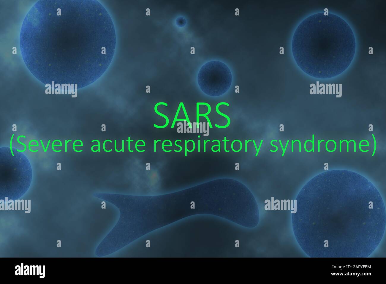 Esempio illustrativo di SARS o Sindrome respiratoria acuta Grave coronavirus su virus e cellulari come sfondo blu. Foto Stock