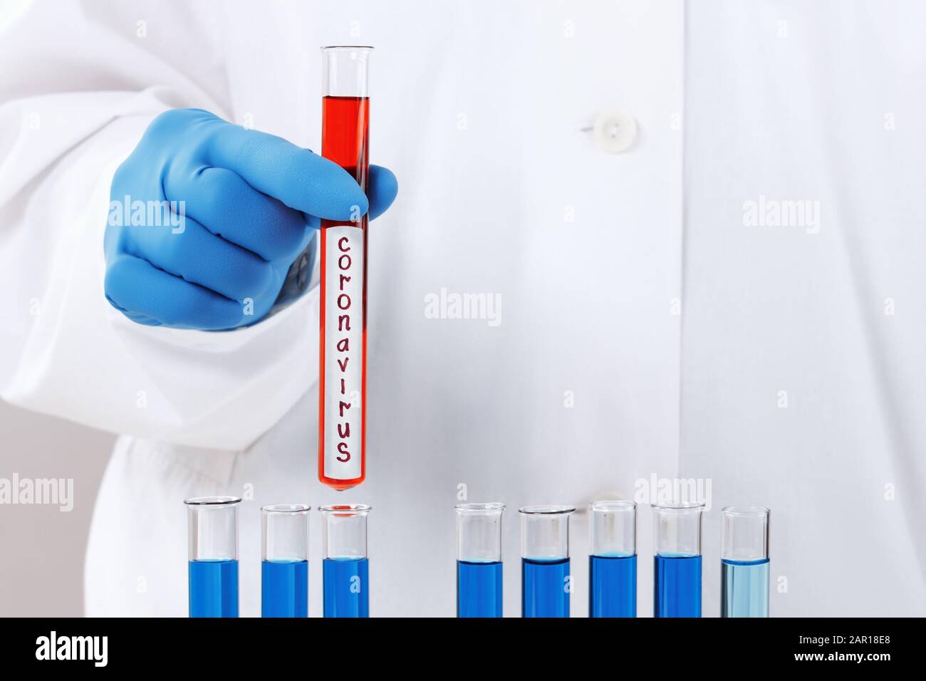 In un laboratorio di chimica, un ricercatore tiene una provetta con il virus del coronavirus. Il concetto di diagnosi tempestiva. Sviluppo del vaccino. Foto Stock