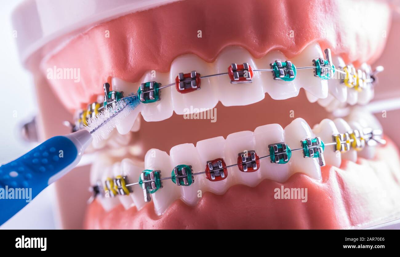 Modello di dente da denti dentari con spazzola per pulizia denti interdentali Foto Stock