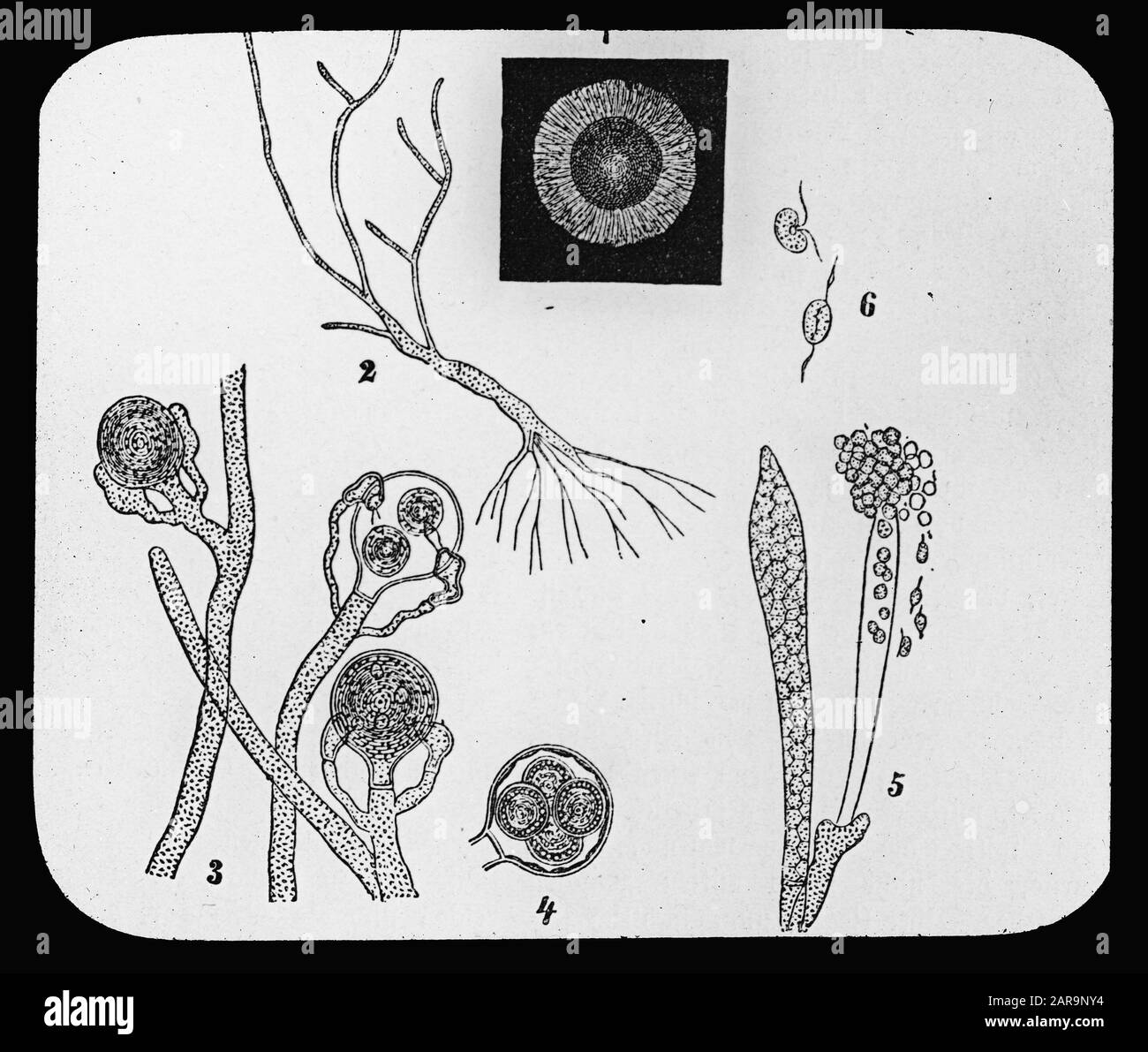 Pesca d'acqua dolce, supregnia, achlya Data: Parole Chiave dense: Pesca d'acqua dolce Nome personale: Achlya, suprolegnia Foto Stock