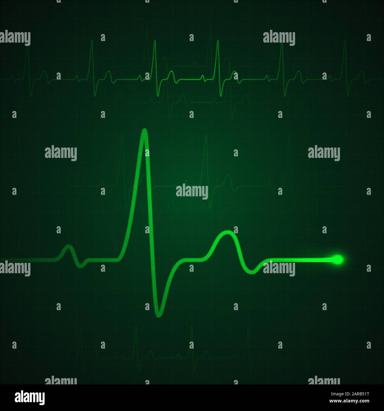 Impulso cardiaco sul display verde. Grafico del battito cardiaco o cardiogramma. Tasso di stress di monitoraggio dei farmaci. Illustrazione del vettore Illustrazione Vettoriale