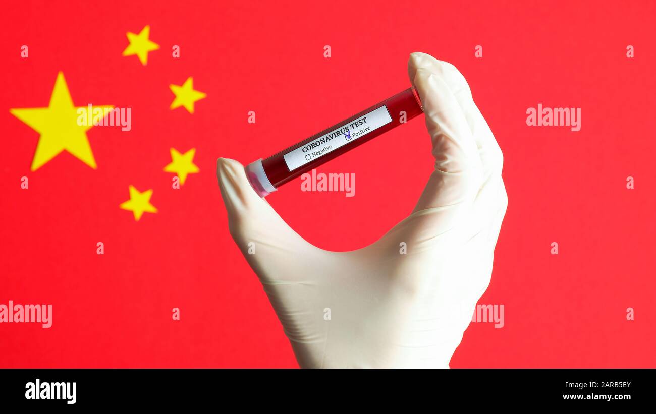 Nuovo concetto di coronavirus 2019-nCoV. Infermiere che tiene la provetta per il sangue con il risultato positivo del test Coronavirus sulla bandiera cinese. Wuhan coronavirus fuori Foto Stock