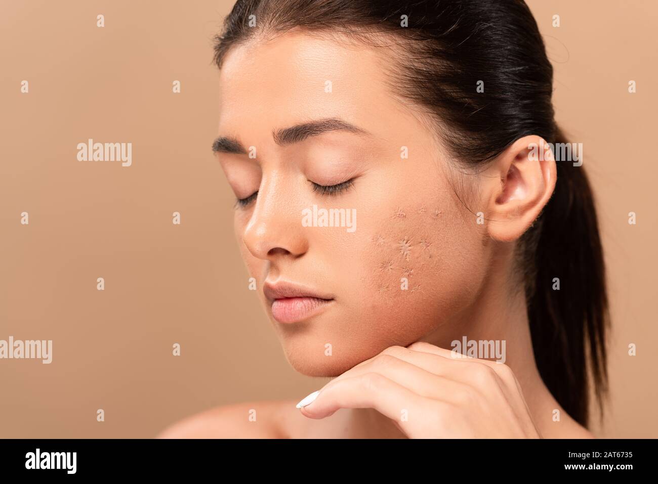 Primo piano del naso di una donna con punti neri o punti neri problemi di  acne comedoni pori dilatati