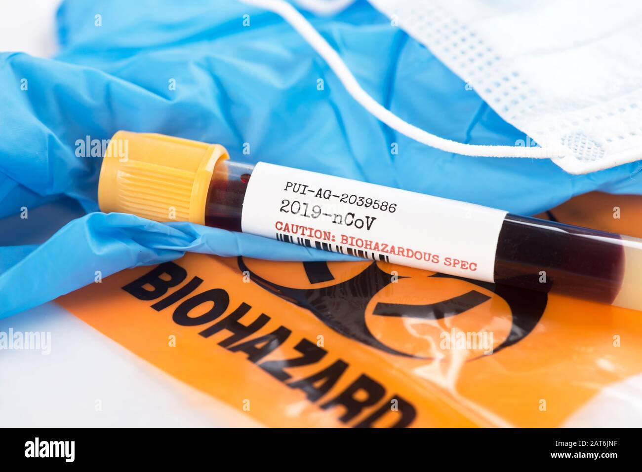 Provetta per analisi del sangue Corona virus 2019-nCoV con guanti, maschera e sacchetto per materiale a rischio biologico. Foto Stock