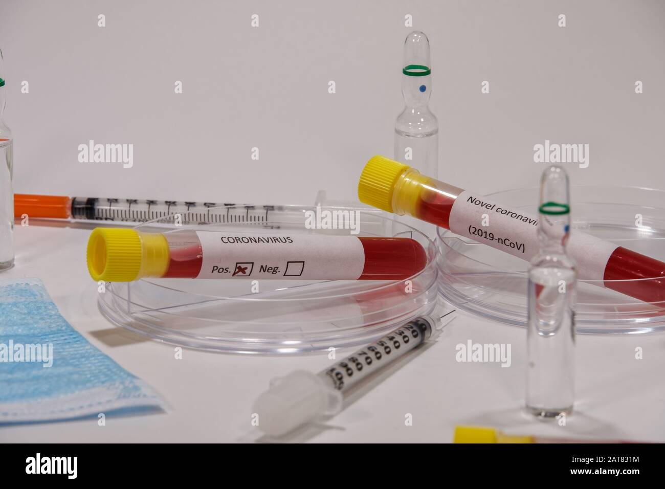 Wuhan Coronavirus COVID-19 2019-nTest di laboratorio di microbiologia CoV.Test di laboratorio di apparecchiature mediche, comprese siringhe e campioni su provette Vacutainer Foto Stock
