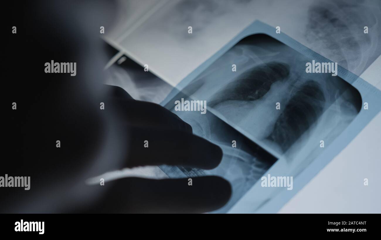 Xray M18 Appendiabiti Per Pellicole Radiografiche Dentali 1 Clip Per 616436 - Foto 8