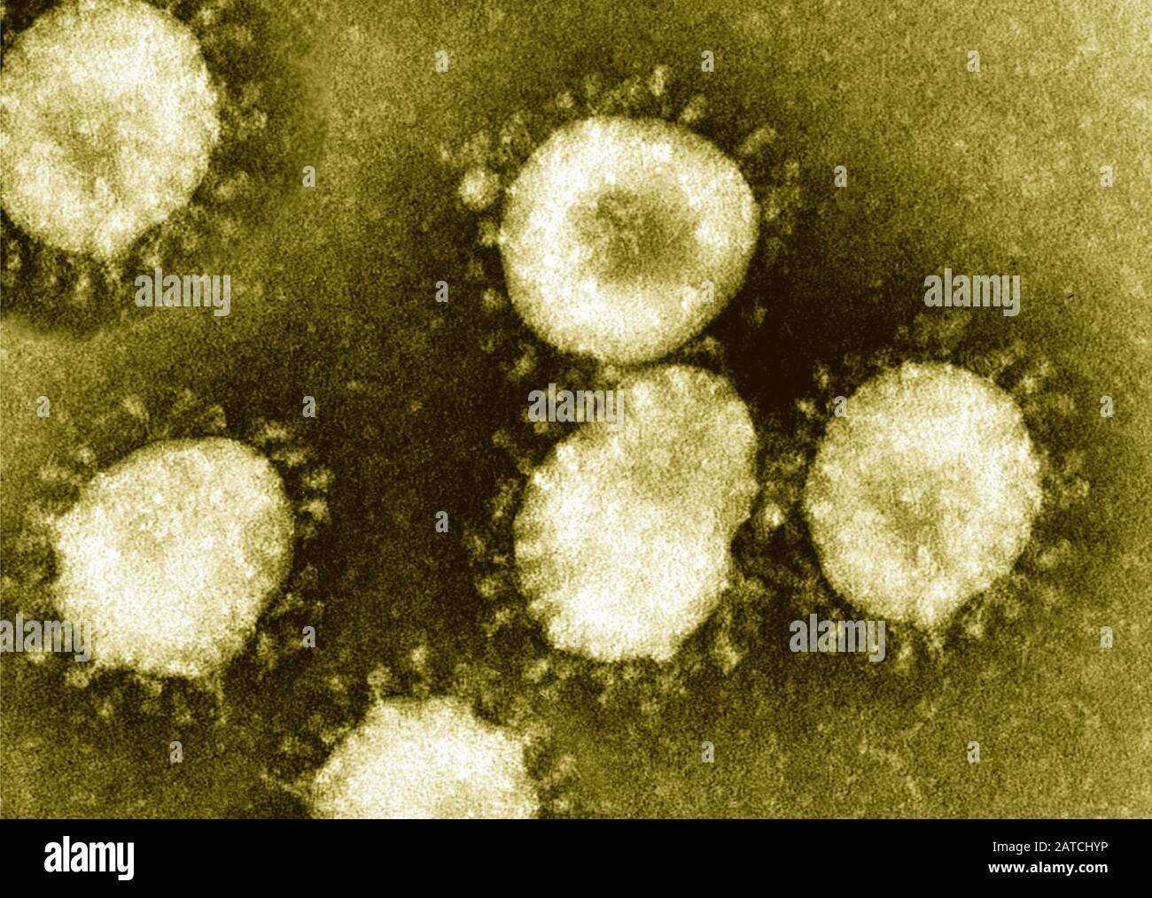 Particelle di coronavirus purificate sotto microscopia elettronica a trasmissione (TEM) Foto Stock