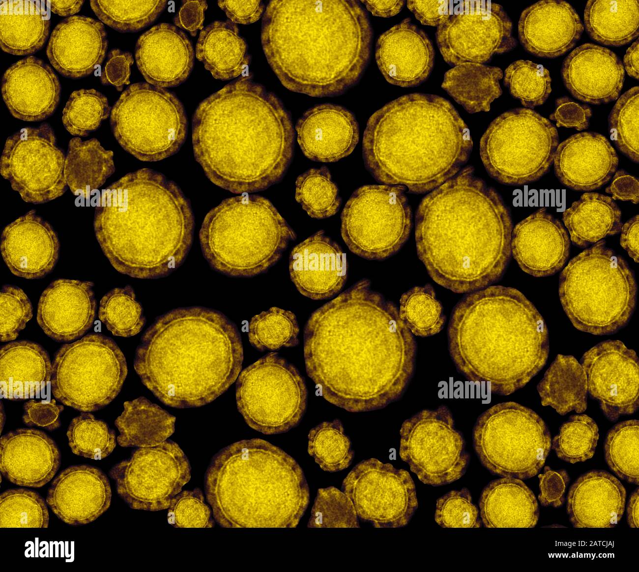 Particolare di ultrastruttura di particelle di coronavirus mortali sotto microscopia elettronica a trasmissione (TEM) Foto Stock