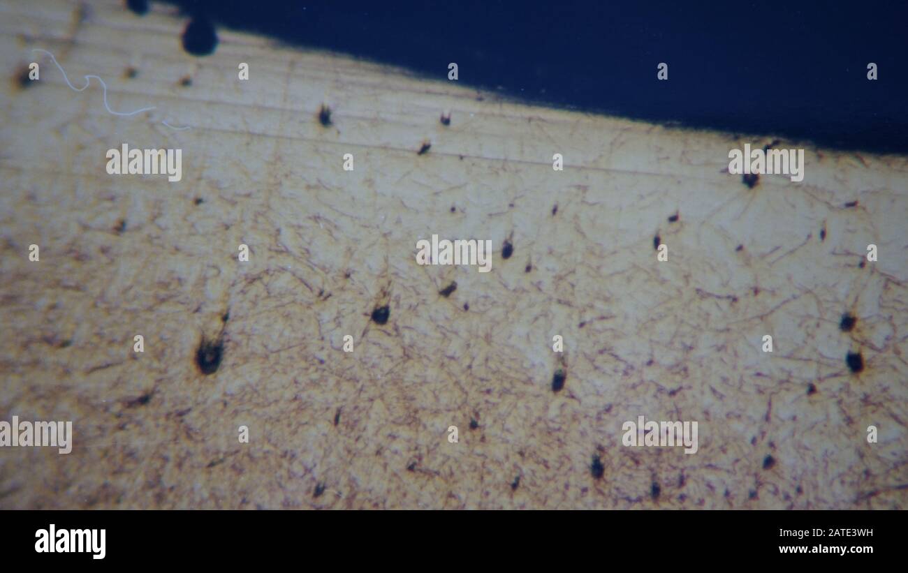 micrografia metallurgica di un albero di pompa cementato e indurito che mostra i lassi martensite Foto Stock