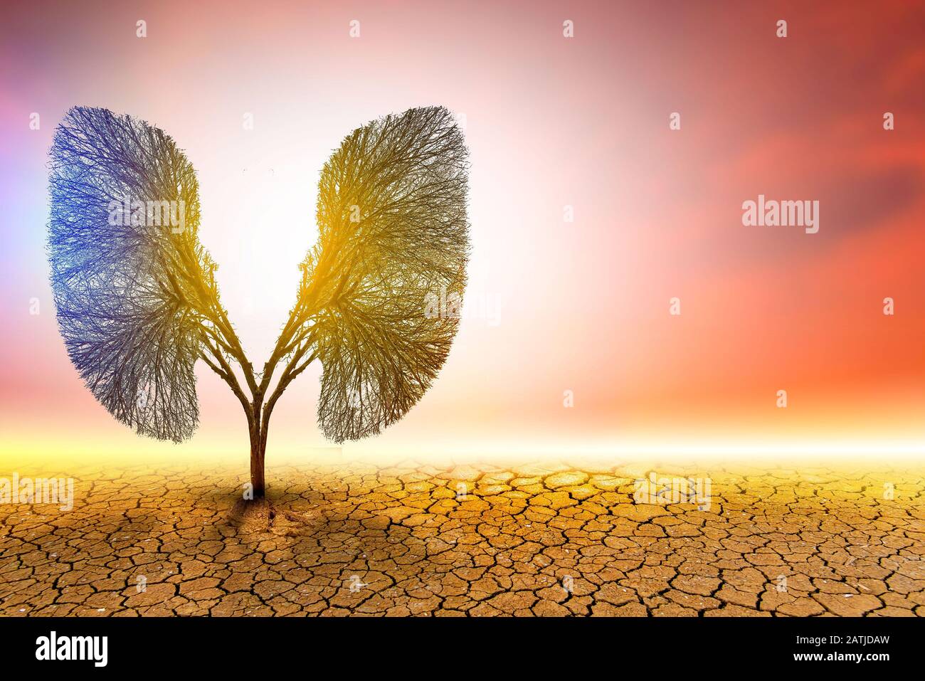 Illustrazione dell'albero polmonare (ambiente e medicina) Foto Stock