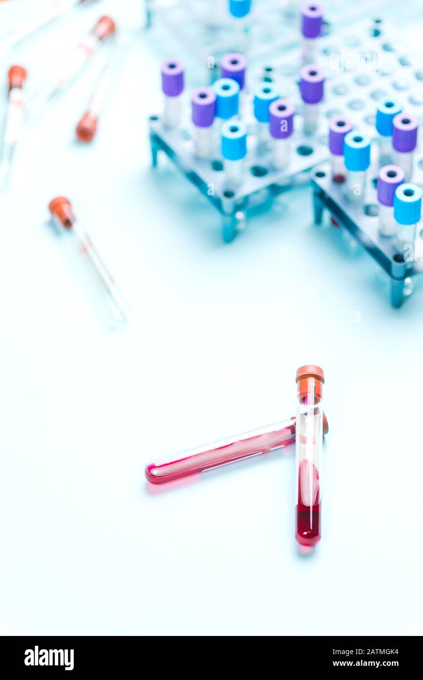 Fiale per provette per campioni di sangue vicino al rastrello con campioni medici, laboratorio di analisi medica. Inserire il testo. Foto Stock