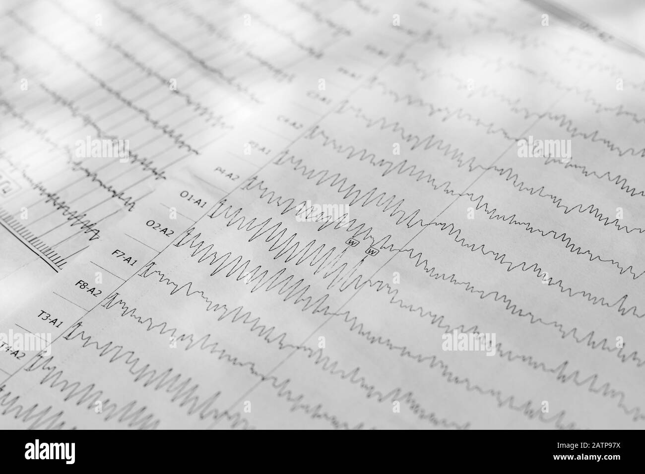 Risultato dell'elettroencefalogramma sull'ostruzione della carta, test di attività cerebrale Foto Stock