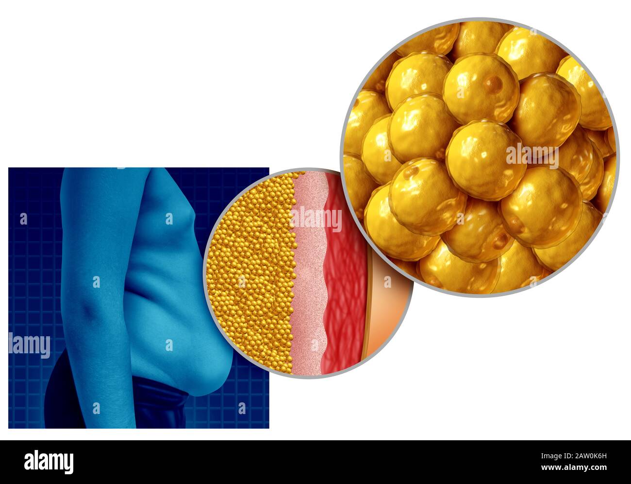 Anatomia del grasso della pancia e guadagnando peso o persone in sovrappeso o obesità come un concetto di salute medica come un aumento nella nutrizione non sana. Foto Stock