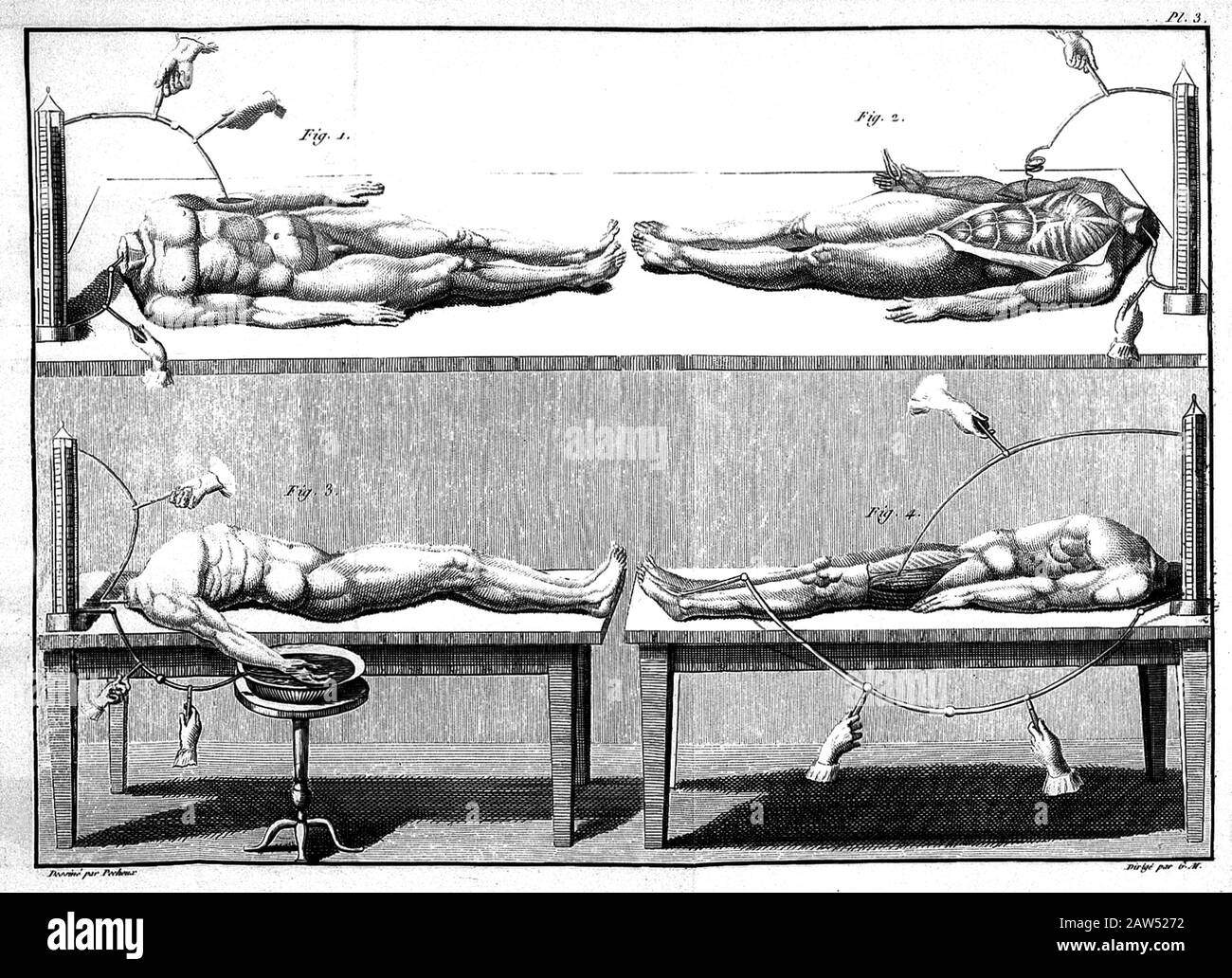 1804 , GRAN BRETAGNA : esperimento umano con elettricità , Piastra 3 , illustrazione del libro ' Essai theorique et experimental sur le galvanisme ' by Foto Stock