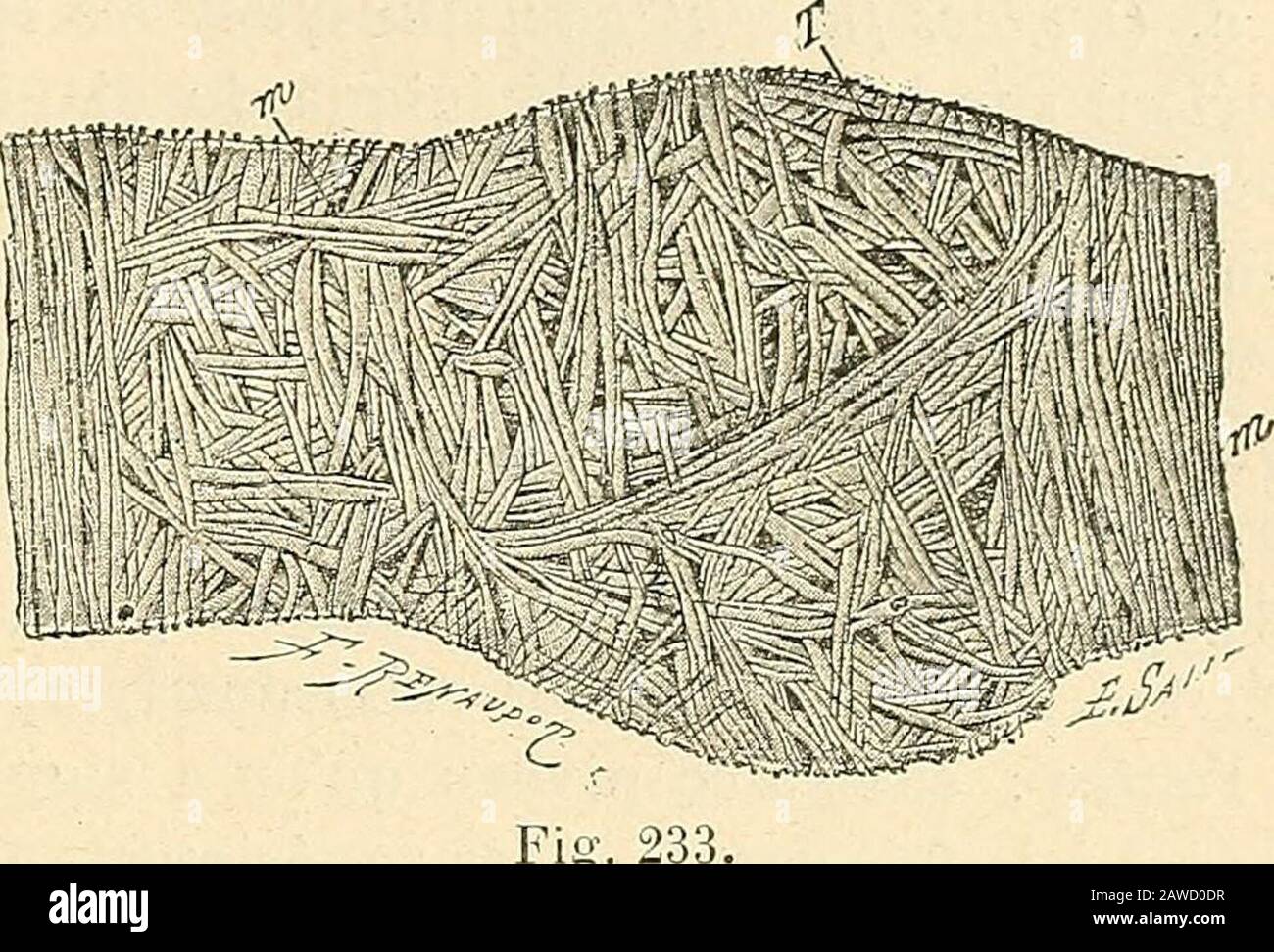 Traité d'anatomie humaine . Fig. 232. Endothéliuiïi linfa-tique, découpé enfeuille de chêne ou en.j(.u de patience. LYMPHATIQUES 331. 5° Troncules et troncs linfohatiques (vaisseaux linphyphatiques proprementits). à des Ironcules, ceux-ci à des troncs. Laparoi de ces vaisseaux nous prégente, Comme celle des artères, trois teuniquesconncentriques, que nous désignerons sous les doms de tunique interne, tuniquemoyenne et tunique externe : a. Internazionale unico. La tunique interne est essentiellement costituée par unendothélium, découpé en feuilles de chêne ou en je Foto Stock