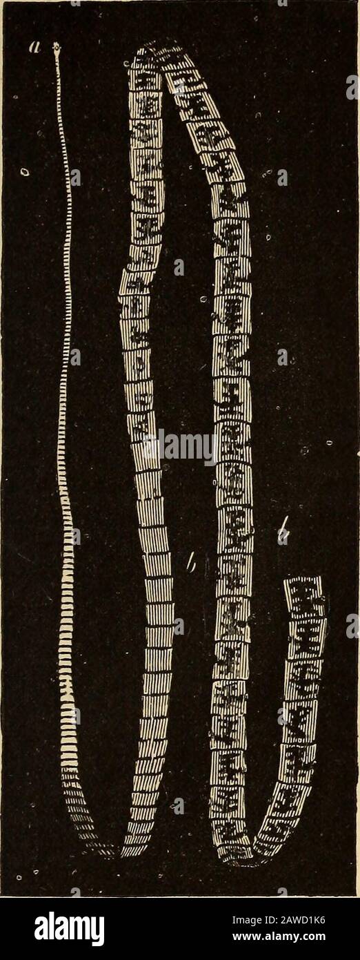 Un trattato sulla pratica della medicina, per l'uso di studenti e praticanti . ar dal solito; anzi, sono eccezionali, e non deter-minato dalla dimensione, numero, carattere, o posizione dei vermi, ma su una particolare sensibilità della persona colpita. CESTODA - TIENIA - VERMI A NASTRO. Varietà.-Taenia solium è la forma più comune in questo paese, taenia saginata viene dopo, mentre il bothriocephalus latus è raro. Cause.- Lo sviluppo di taenia nelle sue diverse fasi è stato dimostrato a fondo. Botriocephalus latU3 ha, tuttavia, finora sfuggito la ricerca. Una reache tape-worm Foto Stock