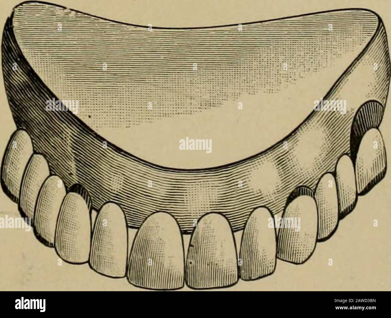 Un trattato pratico sulla corona artificiale e sul ponte . Fig. 366... E posizionamento artistico dei denti artificiali, che sono sporgenze Ion2. 180 LAVORI DI CORONA ARTIFICIALE E PONTE. Foto Stock