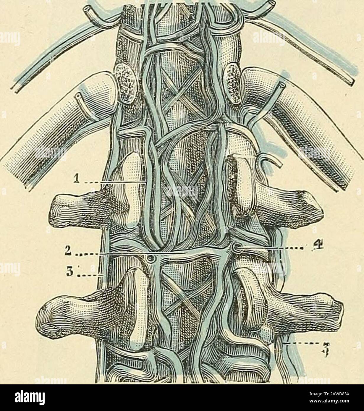 Traité d'anatomie humaine . vertébral. 2, veinespostérieures, formant un plexus dans les gouttièresvertébrales et communicant, en 2,avec les veines intra-rachidiennes. 3, 4, veines intrachidiennes anté-rieures et postérieures. 3, veines intérieures du corpsvertébral.- 6, rami dorso-spinales des veines inter-costales. 296 ANGÉIOLOGIE qui séchappent du Canal rachidien par les Trous de conjugaison, poui- venir sejeter dans les veines extra-rachidiennes : au cou, dans les veines vertébrales ; auxlombes, dans les veines lombaires; au bassin, dans les veines sacées latérales;au dos, d Foto Stock
