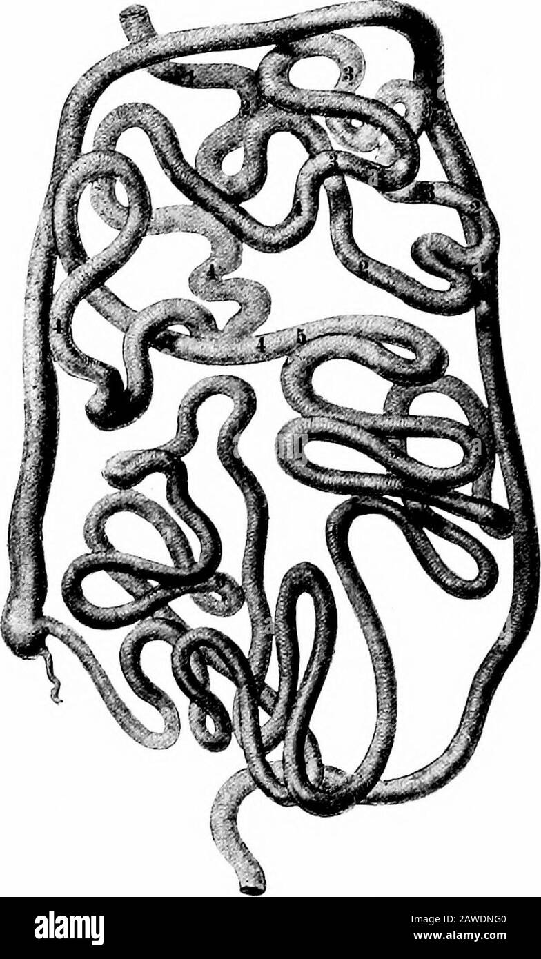 Lo sviluppo del corpo umano; un manuale di embriologia umana . Fig. Ricostruzione Dell'Intestino di Un Embrione di 19 mm. Le figure Sull'Intestino Indicano Le Bobine primarie (Mall.) le bobine secondarie dell'intestino tenue diventano più numer-ous e la parte inferiore dell'intestino crasso è in un'ansa che si estende trasversalmente attraverso la parte inferiore della cavità addominale e rappresenta il sigmoidflexure del colon. Al momento della nascita questa porzione dell'intestino crasso è relativamente più lunga rispetto all'adulto, per un valore di quasi la metà dell'intera lunghezza del thecolon (Tr Foto Stock